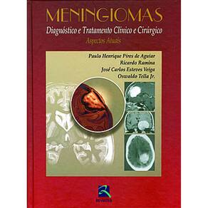 Meningiomas Diagnostico E Tratamento Clinico E Cirurgico