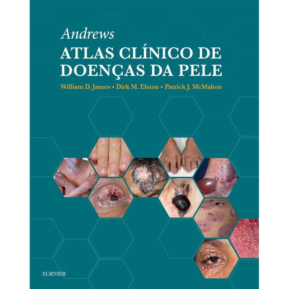 Andrews Atlas Clinico De Doencas Da Pele