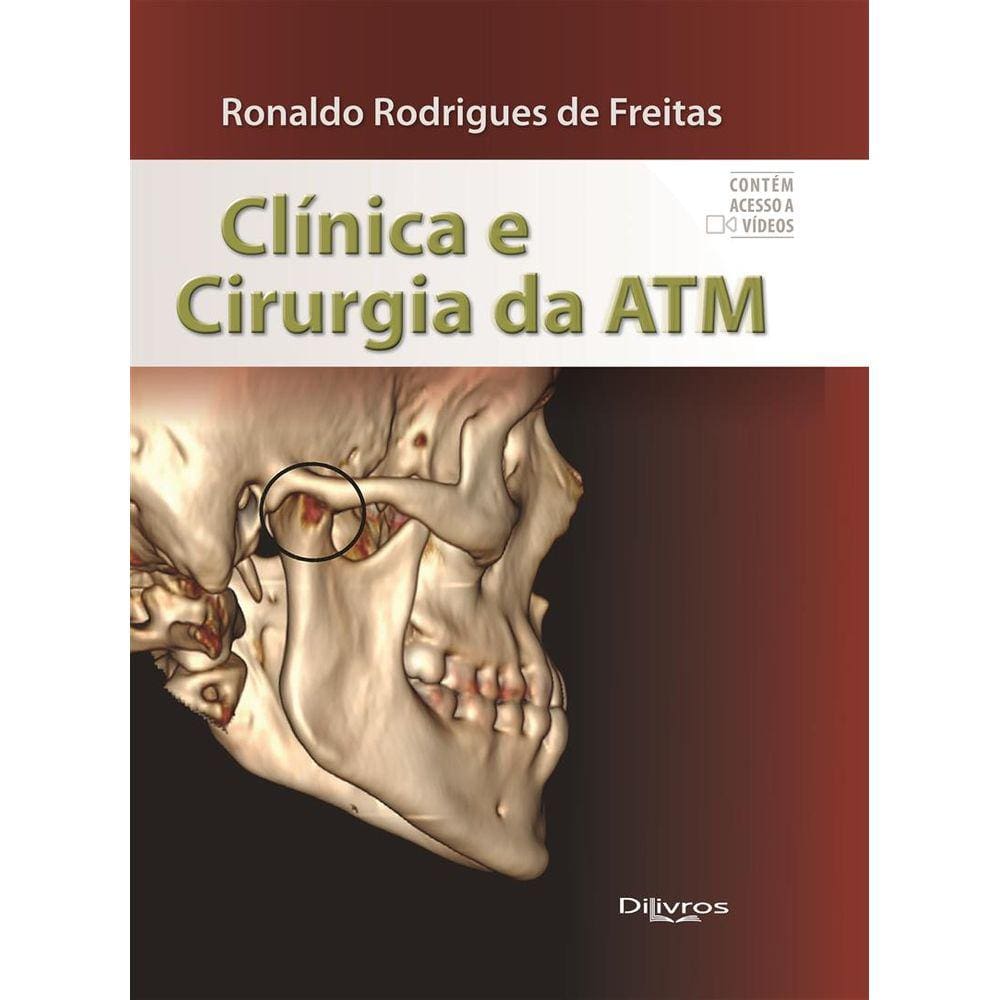 Clinica E Cirurgia Da Atm