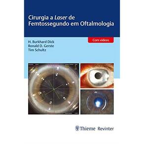 Cirurgia A Laser De Femtossegundo Em Oftalmologia Com Video