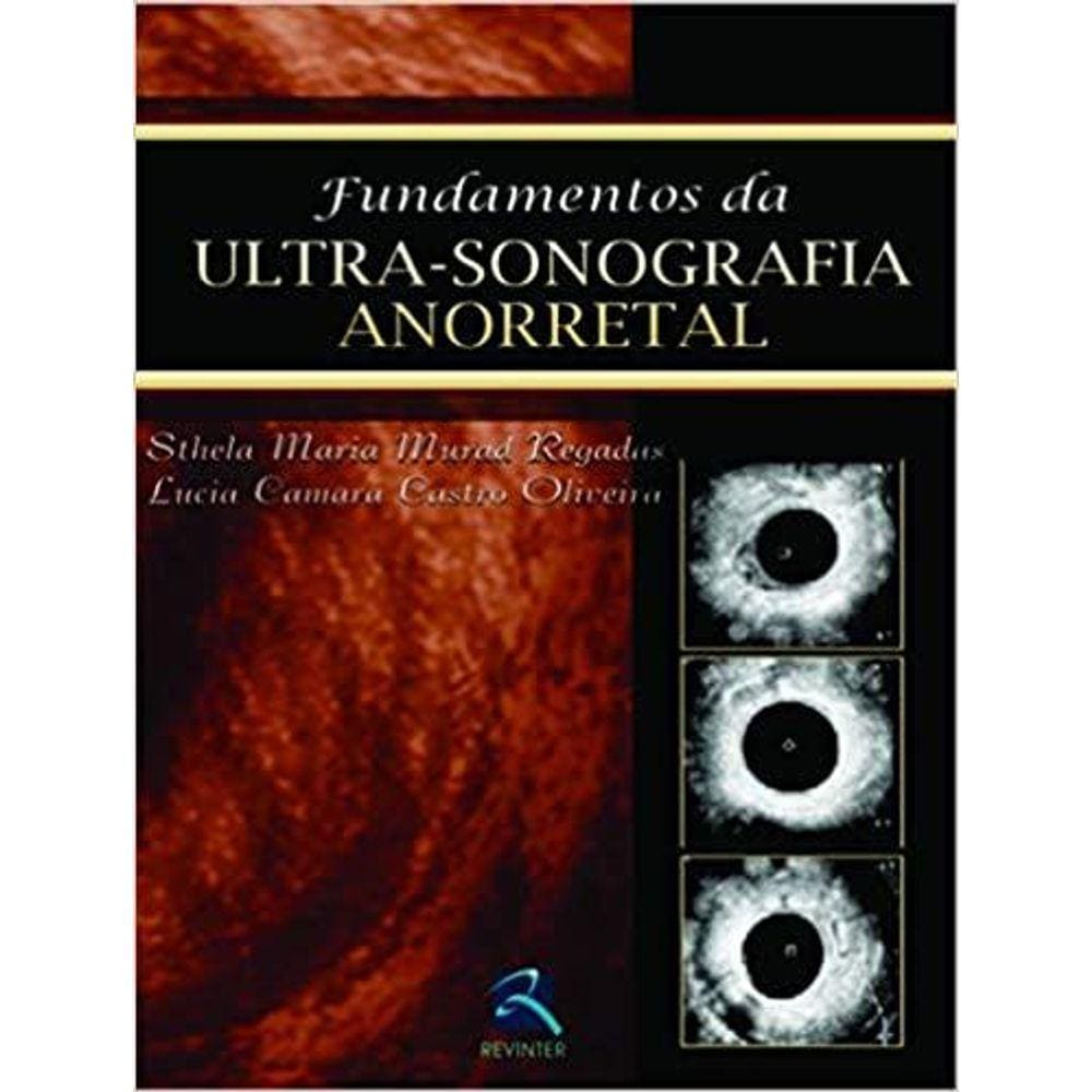 Fundamentos Da Ultra Sonografia Anorretal