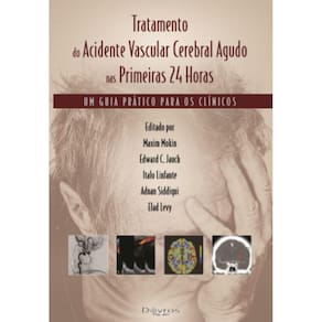 Tratamento Vascular Cerebral Agudo Nas Primeiras 24 Hs