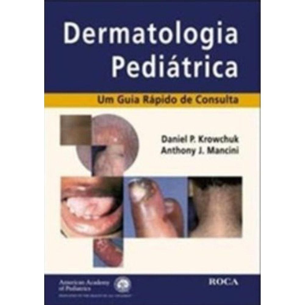 Dermatologia Pediatrica - Um Guia Rapido De Consulta