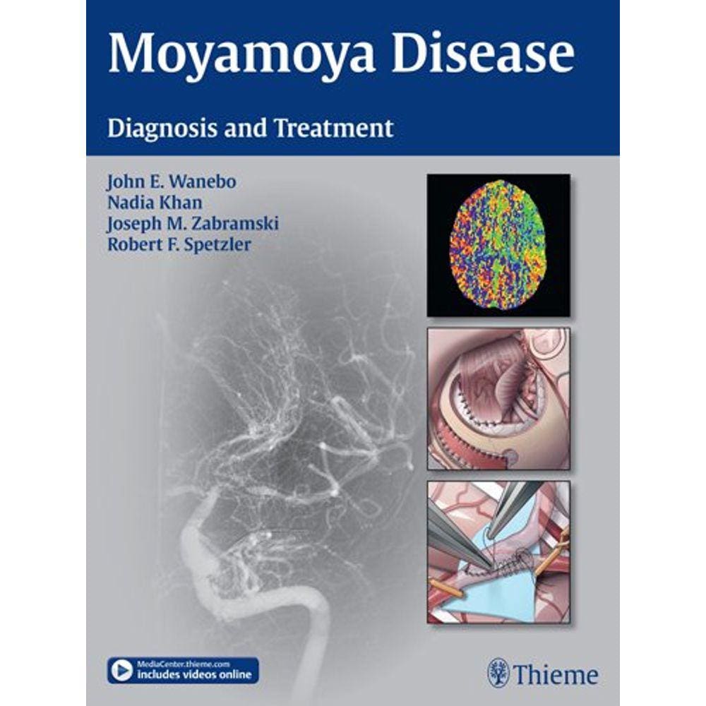 Moyamoya Disease