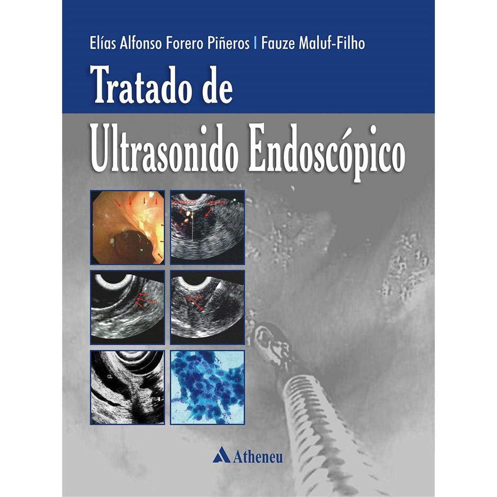 Tratado de Ultrasonido Endoscópico