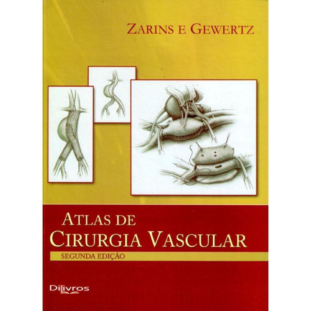 Atlas De Cirurgia Vascular