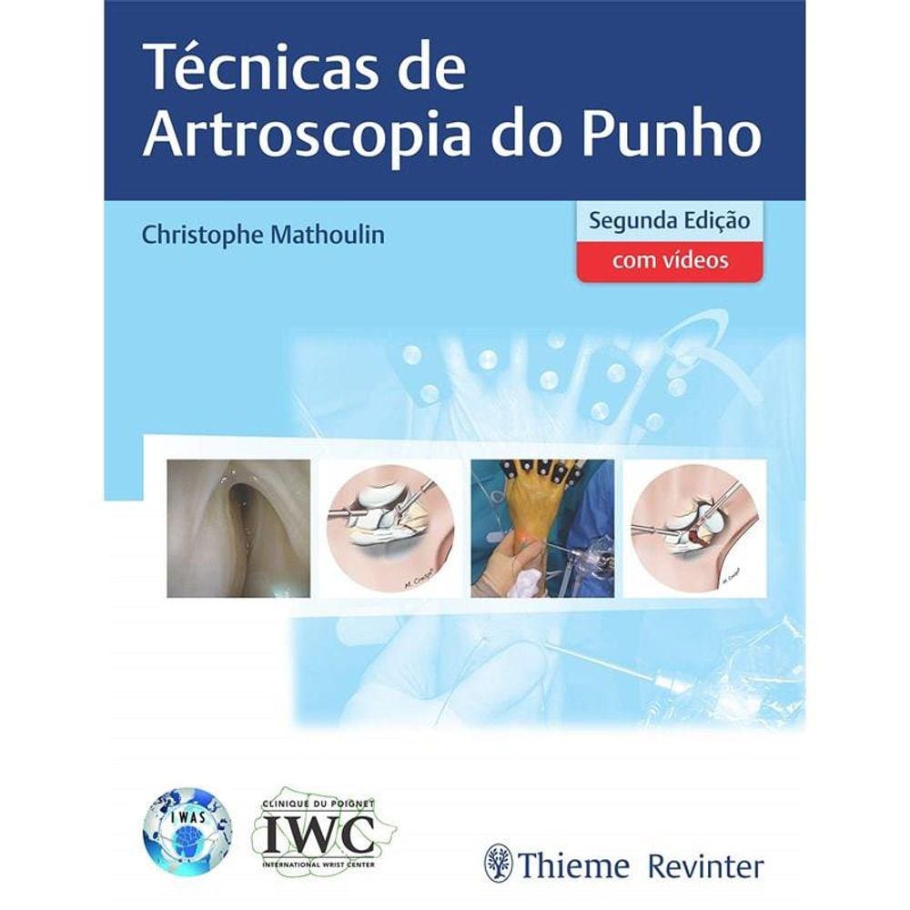 Tecnicas De Artroscopia Do Punho  Com Video