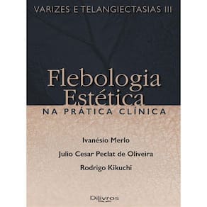 Varizes E Telangiectasias Iii - Flebologia Estetica Na Pratica Clinica