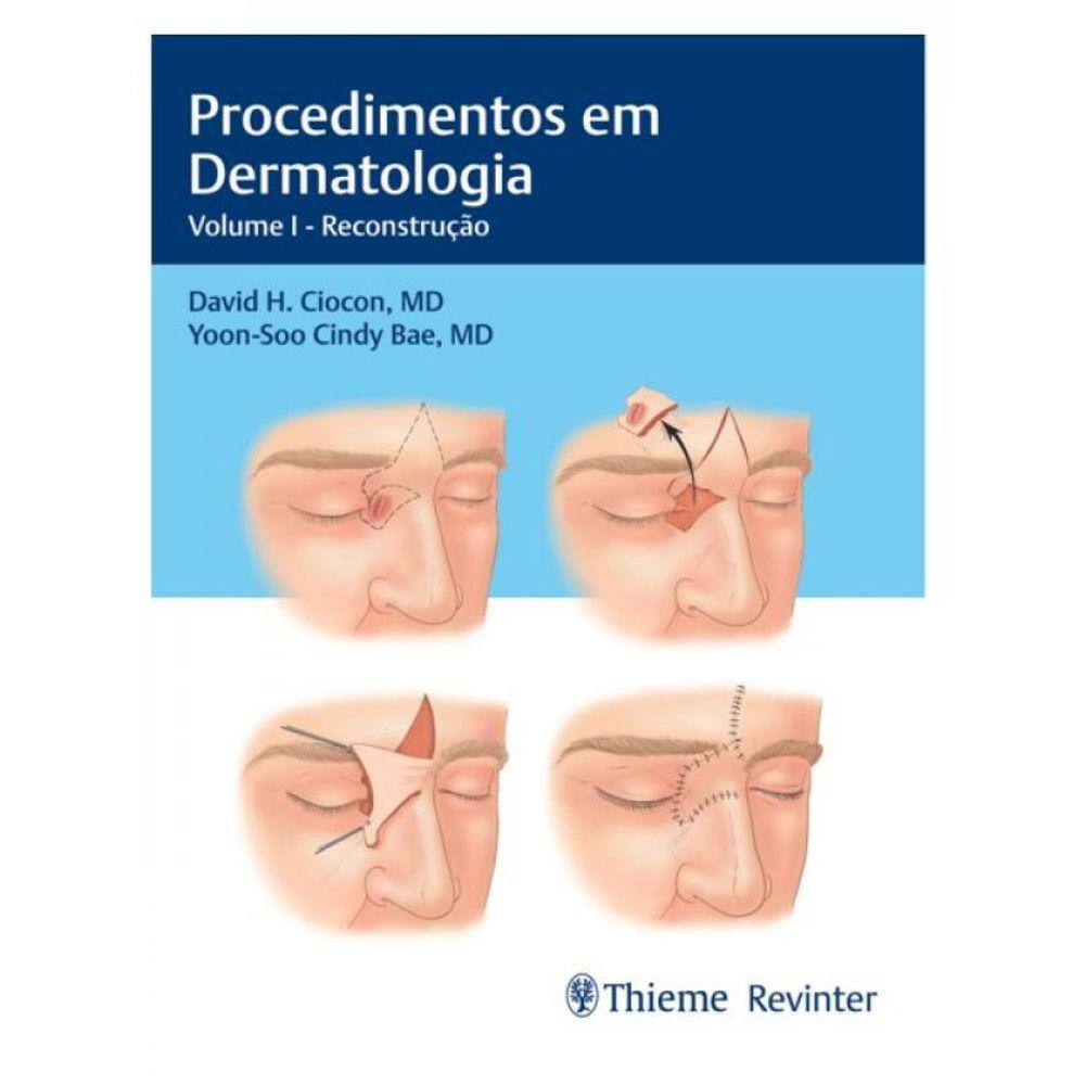 Procedimentos Em Dermatologia