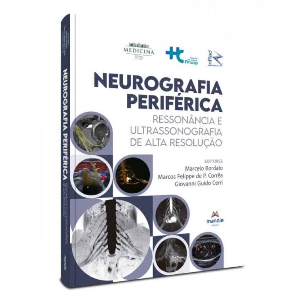 Neurografia Periférica
