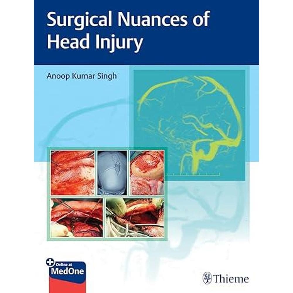 Surgical Nuances Of Head Injury