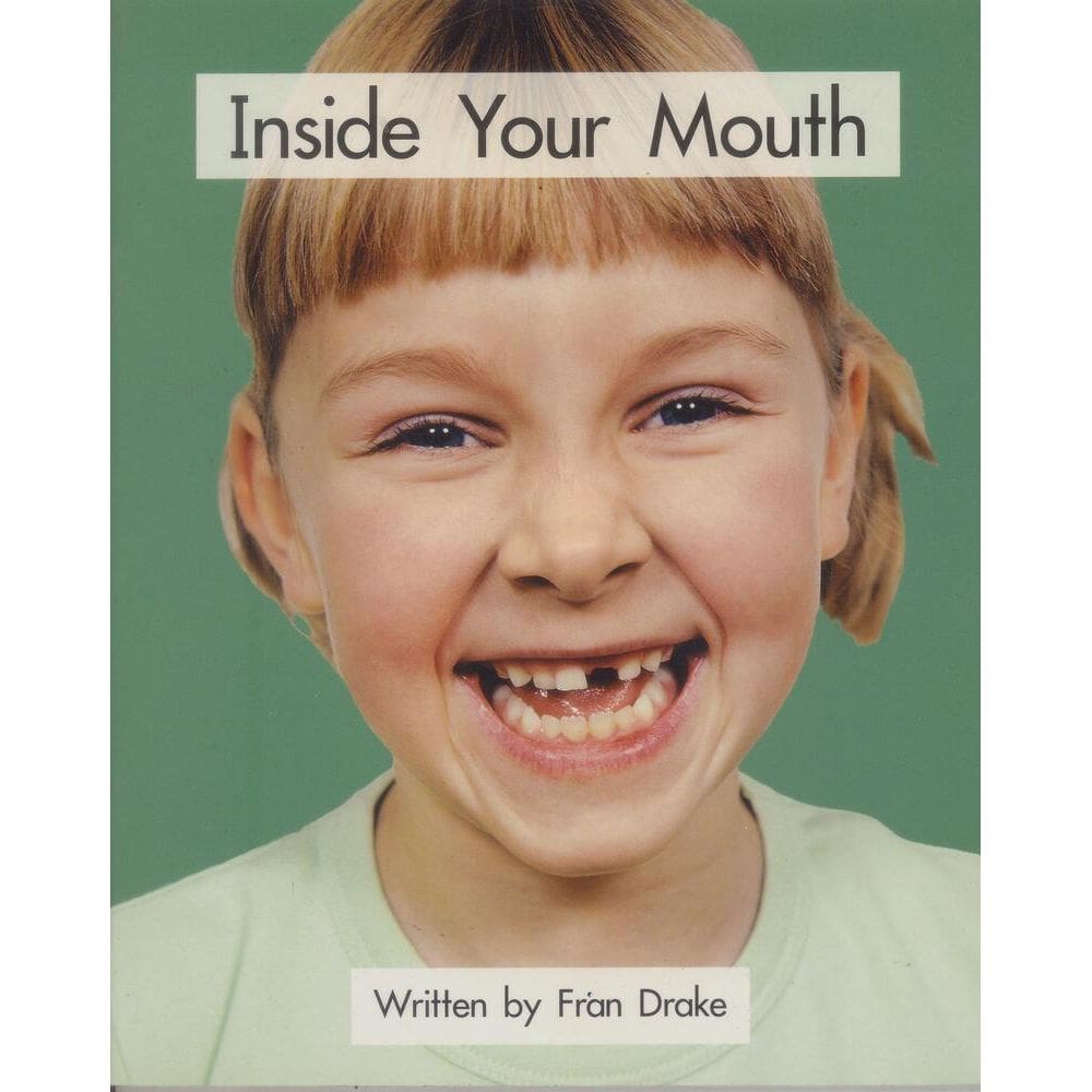 Inside Your Mouth! – 21