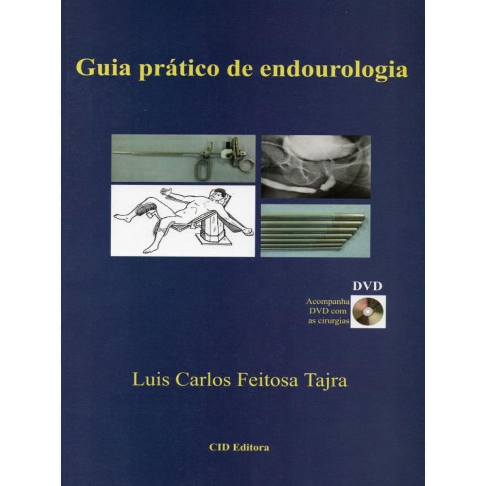Guia Prático De Endourologia