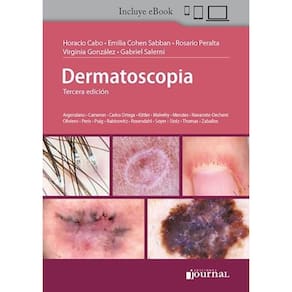 Dermatoscopia  (Espanhol)