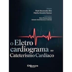 O Eletrocardiograma No Cateterismo Cardiaco