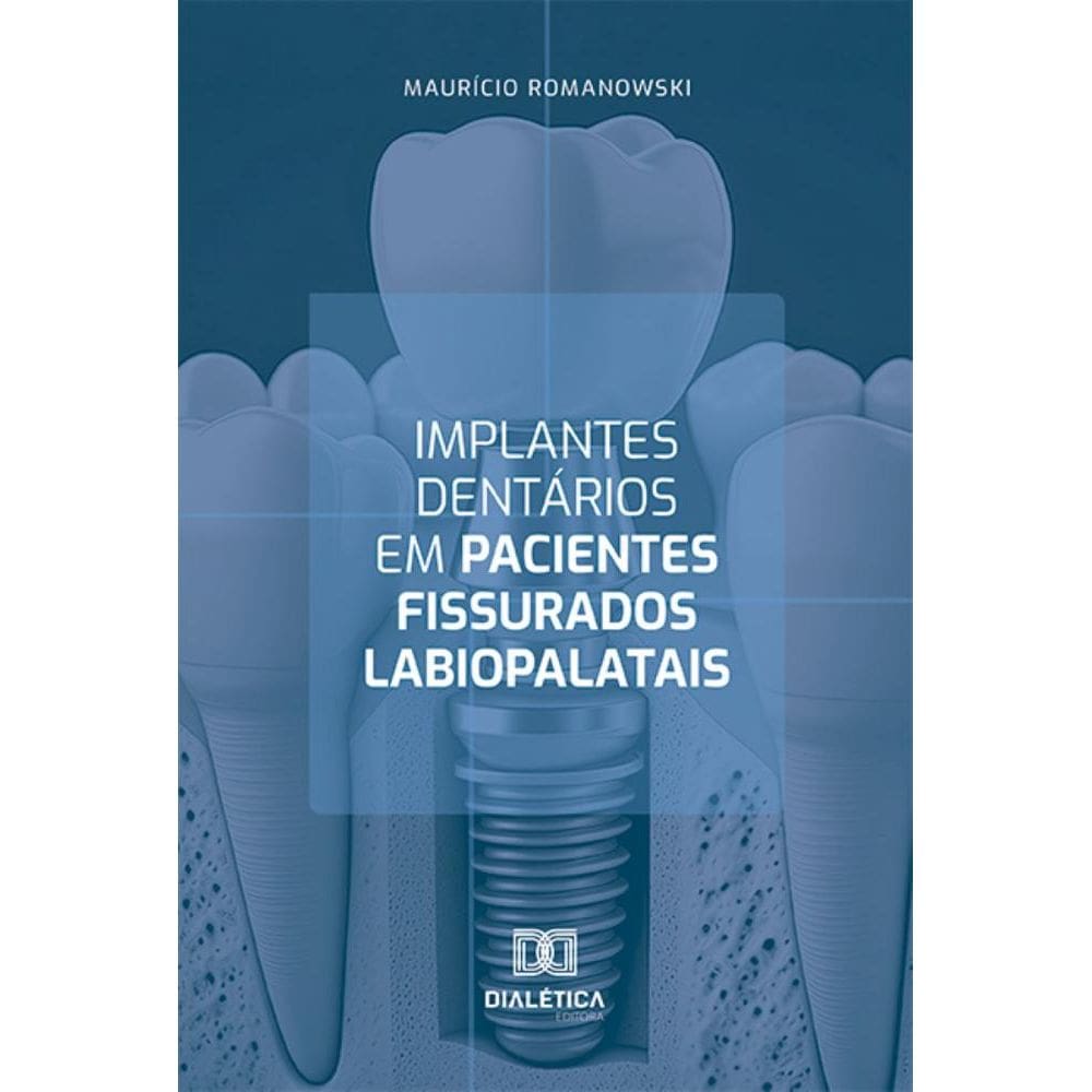 Implantes dentários em pacientes fissurados labiopalatais