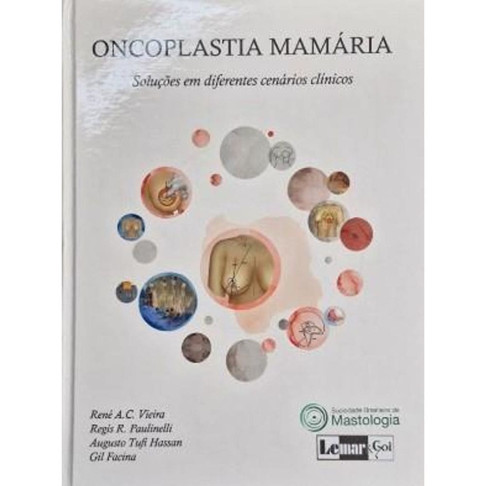 Oncoplastia Mamaria