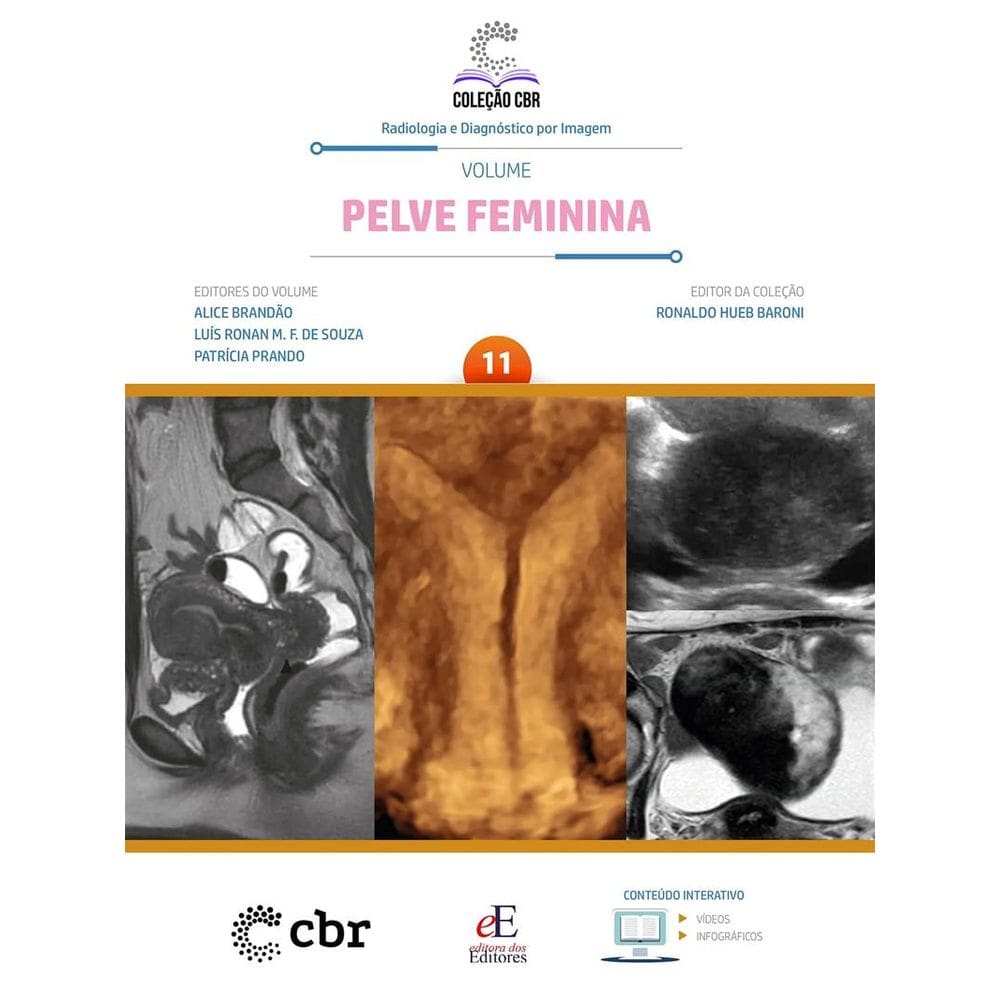 Coleção CBR Volume 11: Pelve Feminina