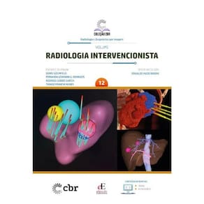 Coleção Cbr Volume 12: Radiologia Intervencionista