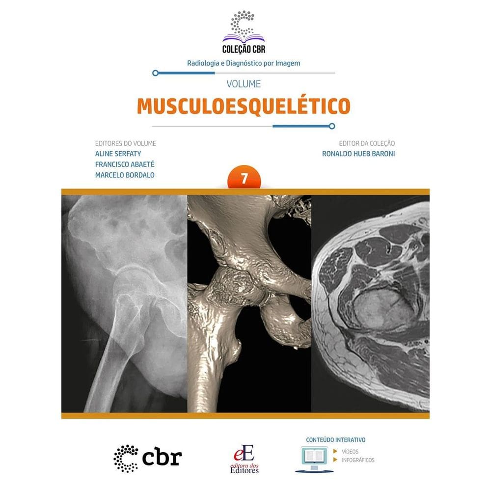 Coleção CBR Volume 7: Musculoesquelético