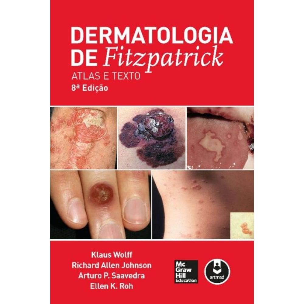 Dermatologia de Fitzpatrick