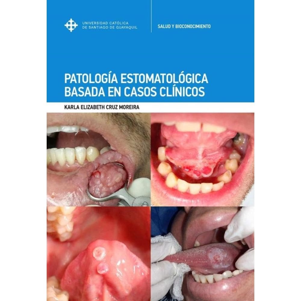 Patología Estomatológica basada en casos clínicos-Espanhol