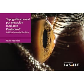 Topografía corneal por elevación mediante Pentacam® - Espanhol