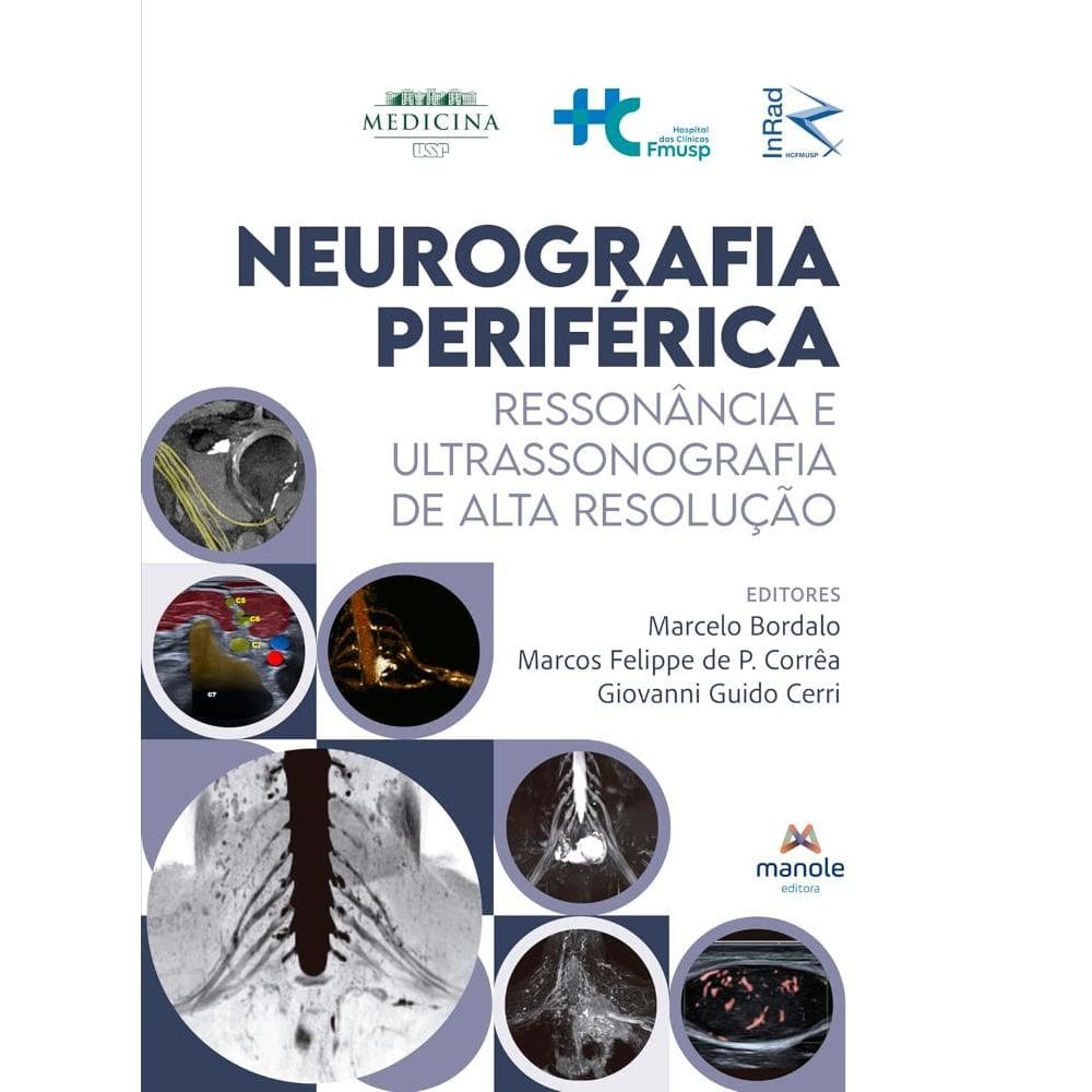 Neurografia periférica