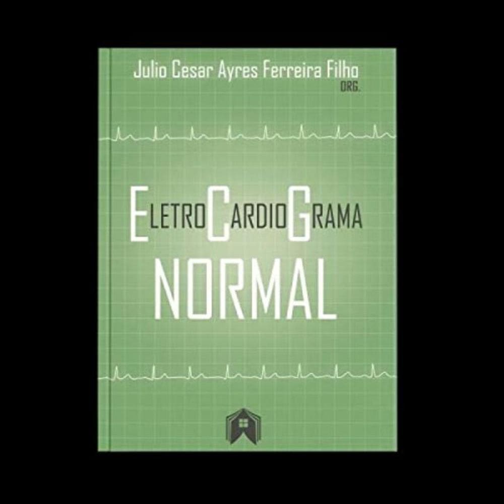 Eletrocardiograma Normal