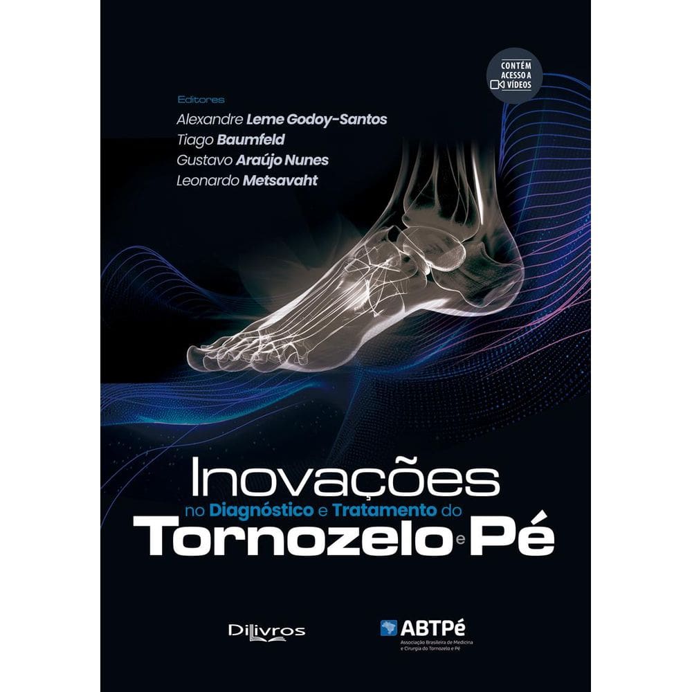 Inovacoes No Diagnostico E Tratamento Do Tornozelo E Pe