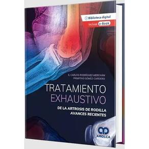 Tratamiento Exhaustivo De La Artrosis De Rodilla