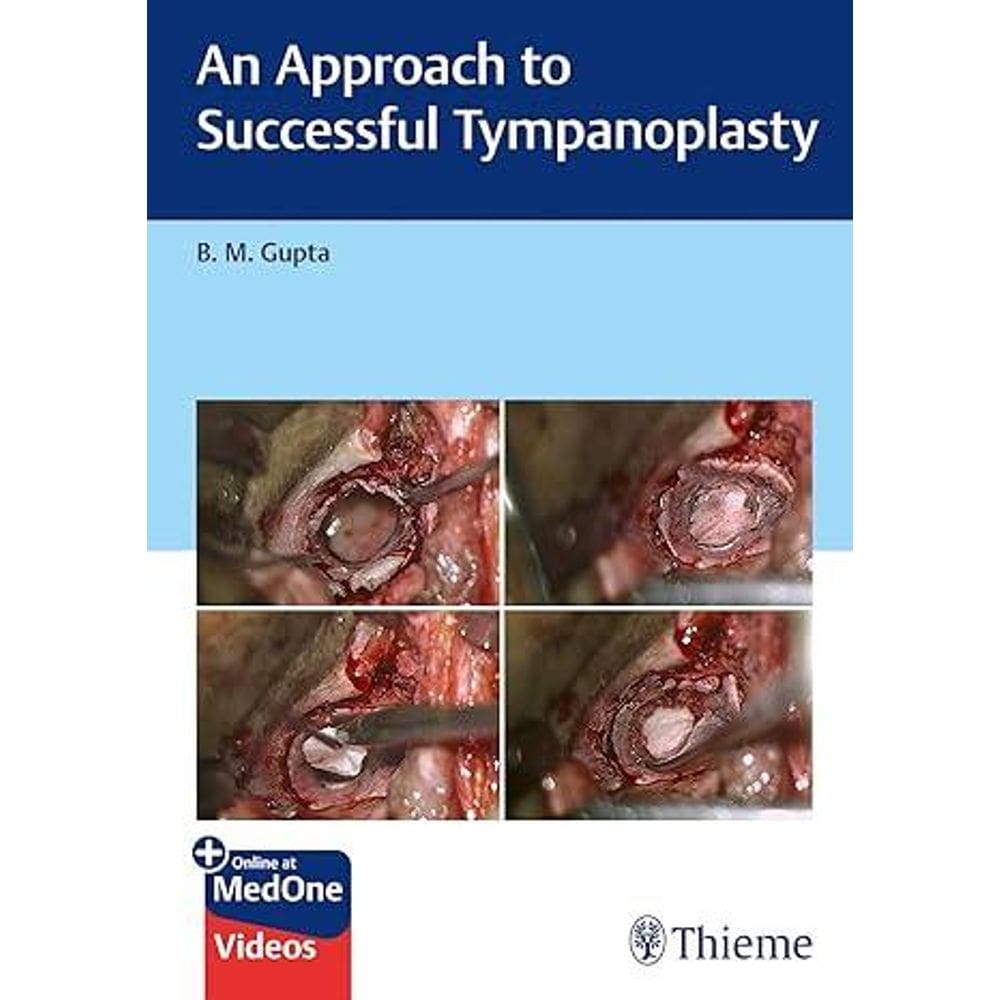An Approach To Successful Tympanoplasty