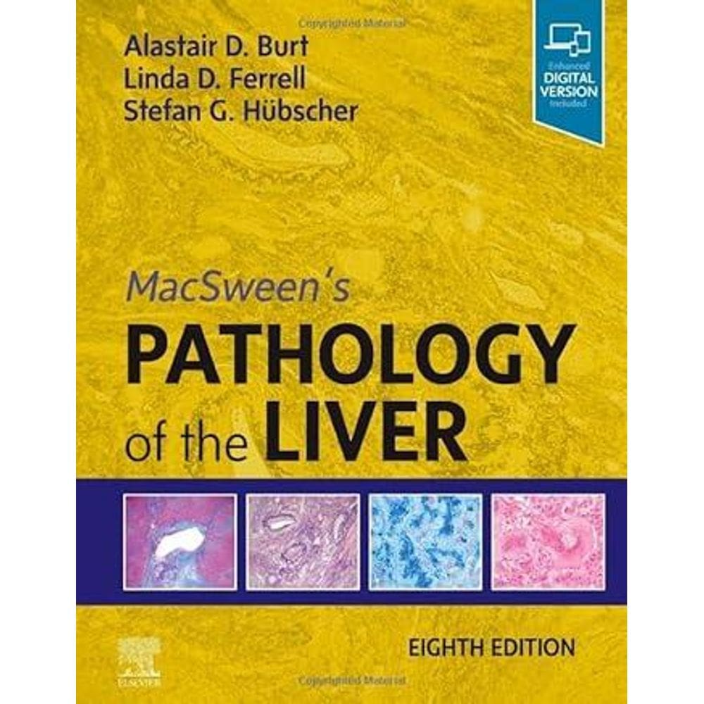 MacSween s Pathology of the Liver
