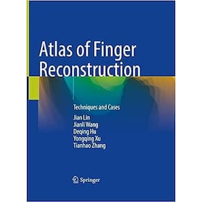 Atlas Of Finger Reconstruction