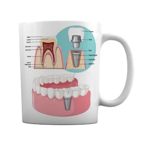 Caneca Branca Dentista Prótese Dentária Implante Dentário