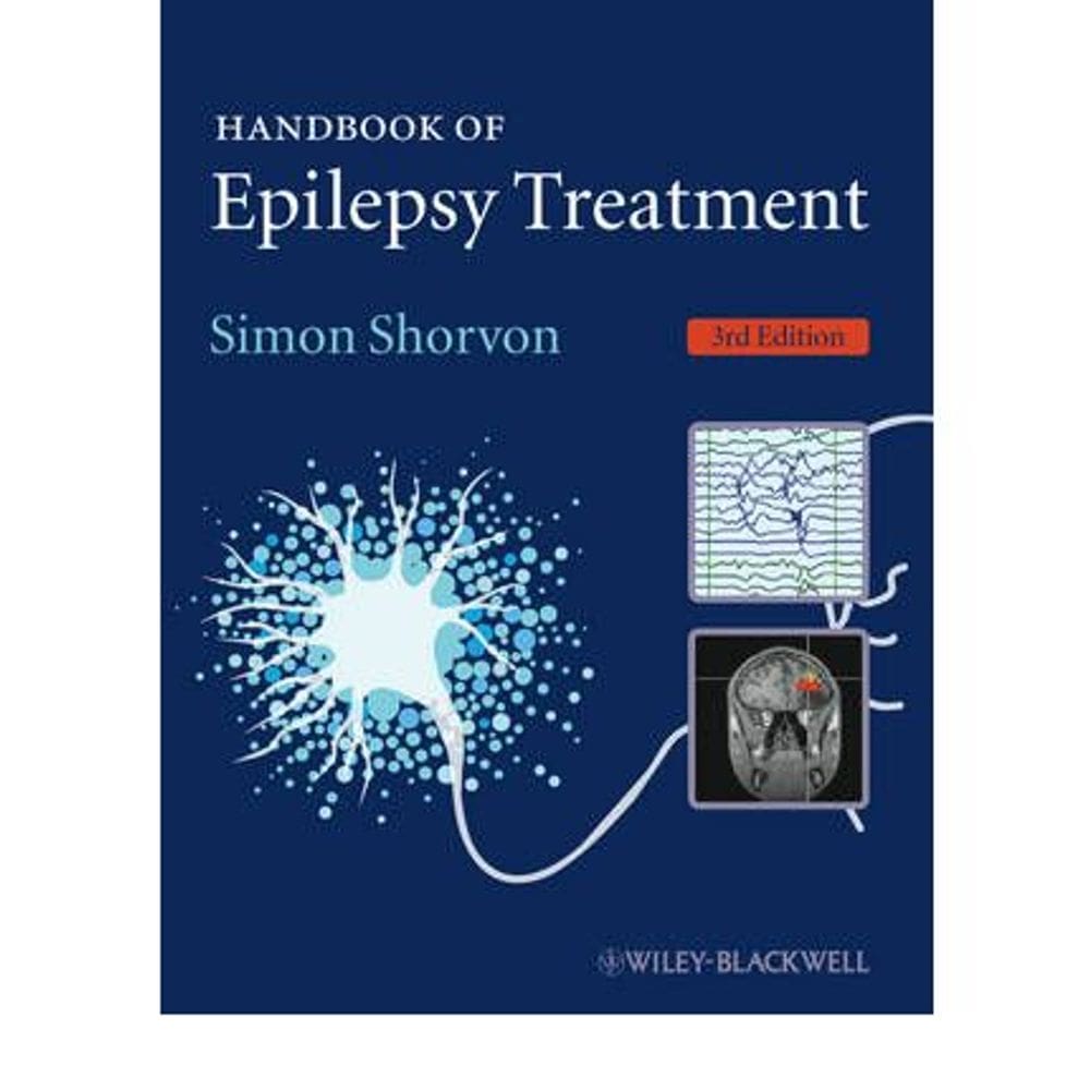 Handbook Of Epilepsy Treatment 