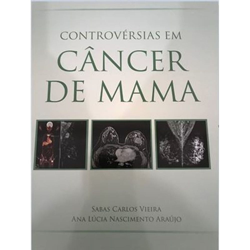 Controvérsias em Câncer de Mama
