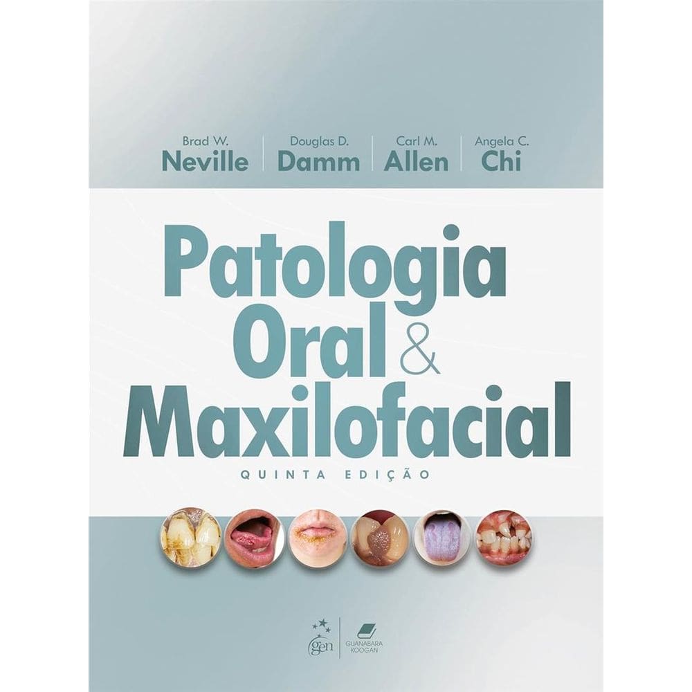 Patologia Oral e Maxilofacial