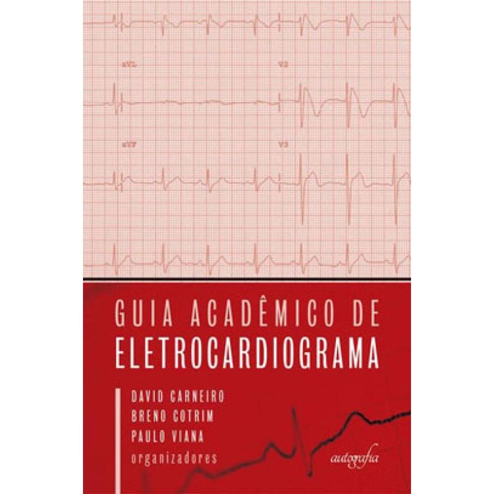 Guia Acadêmico De Eletrocardiograma