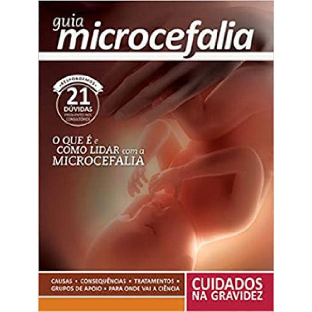Guia Microcefalia