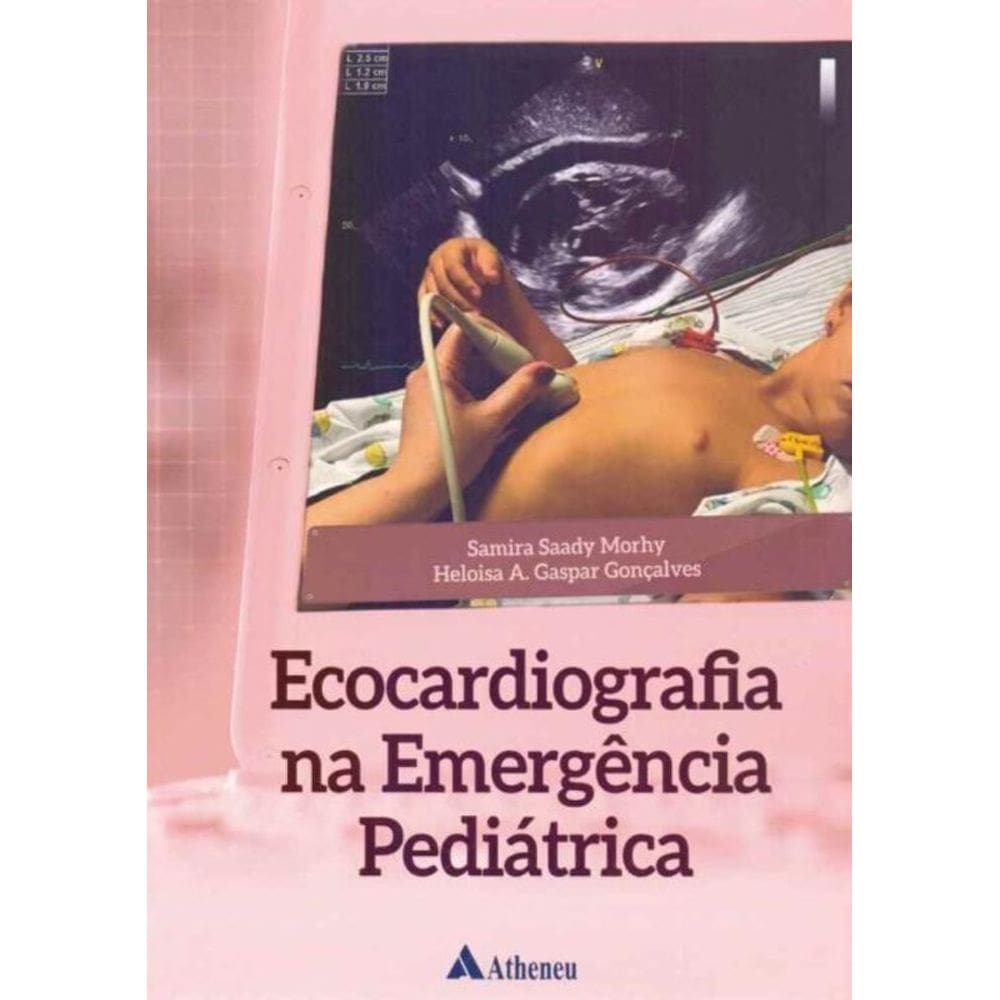 Ecocardiografia na Emergência Pediátrica