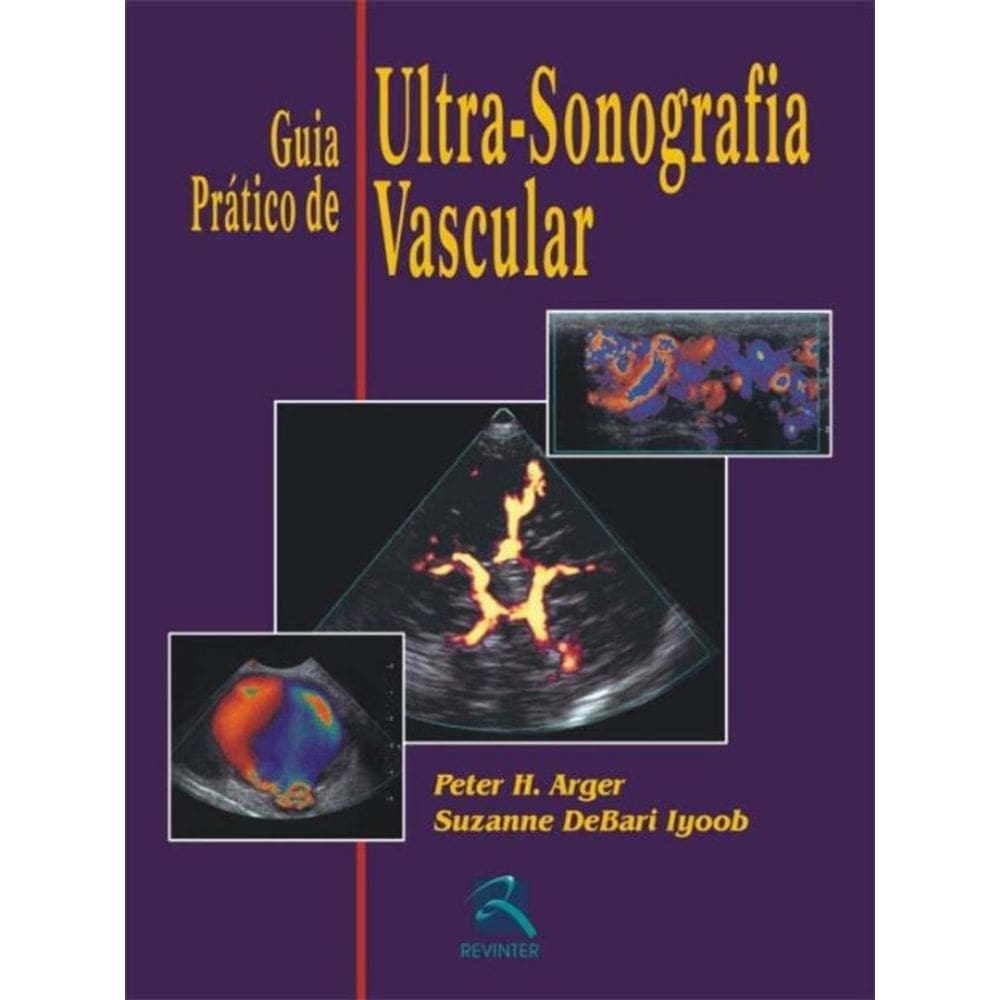 Guia Prático De Ultrassonografia Vascular