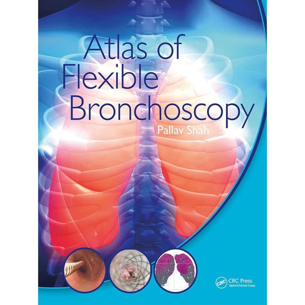 Atlas Of Flexible Bronchoscopy