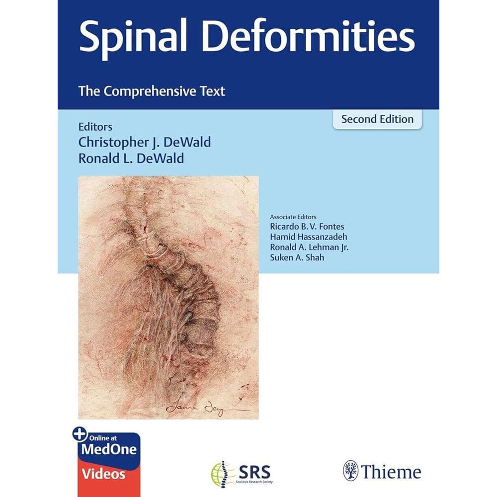 Spinal Deformities The Comprehensive Text