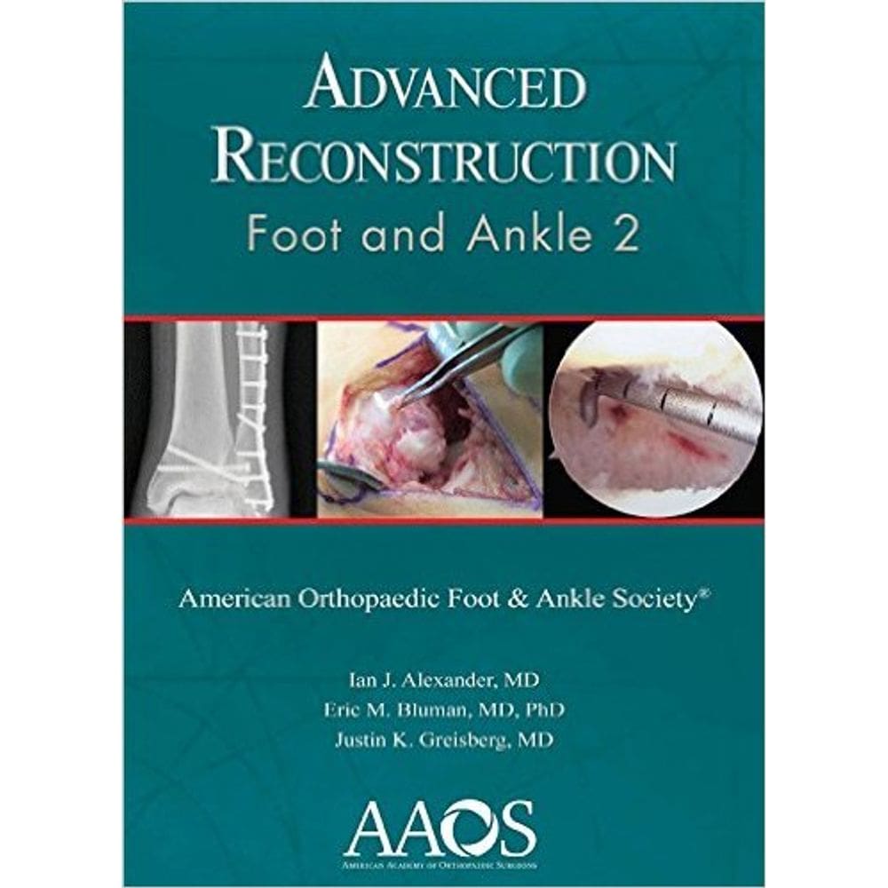 Advanced Reconstruction: Foot And Ankle 2
