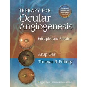 Therapy For Ocular Angiogenesis Principles And Practice