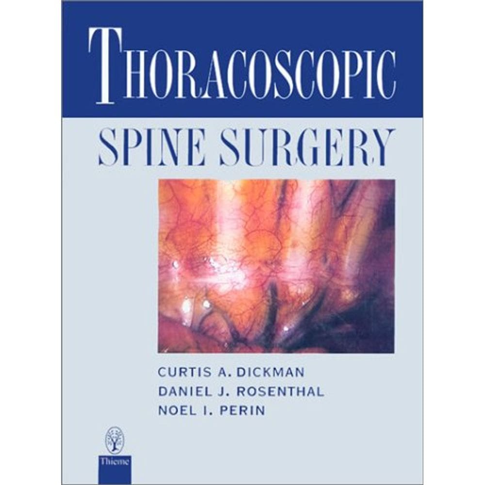 Thoracoscopic Spine Surgery