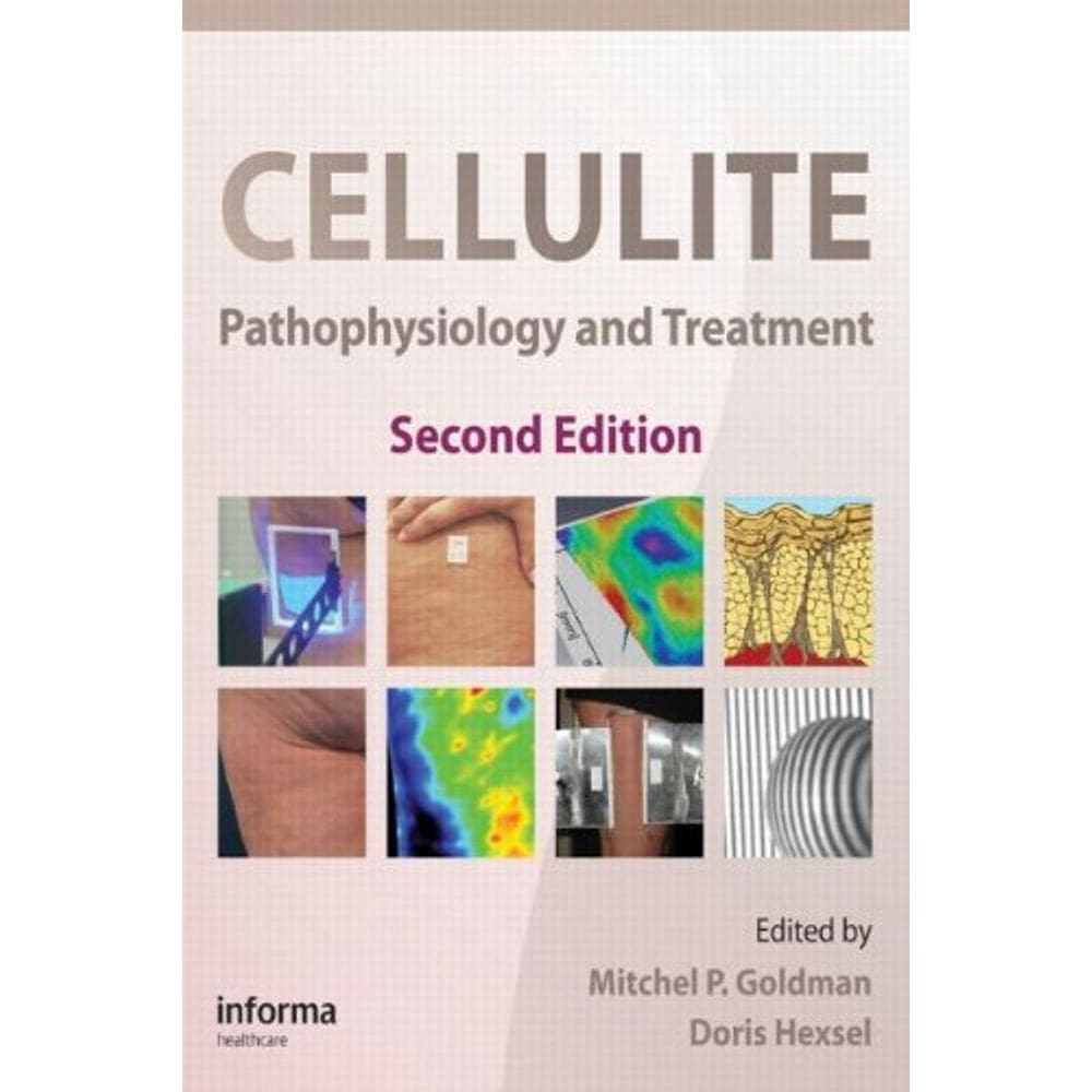 Cellulite: Pathophysiology And Treatment