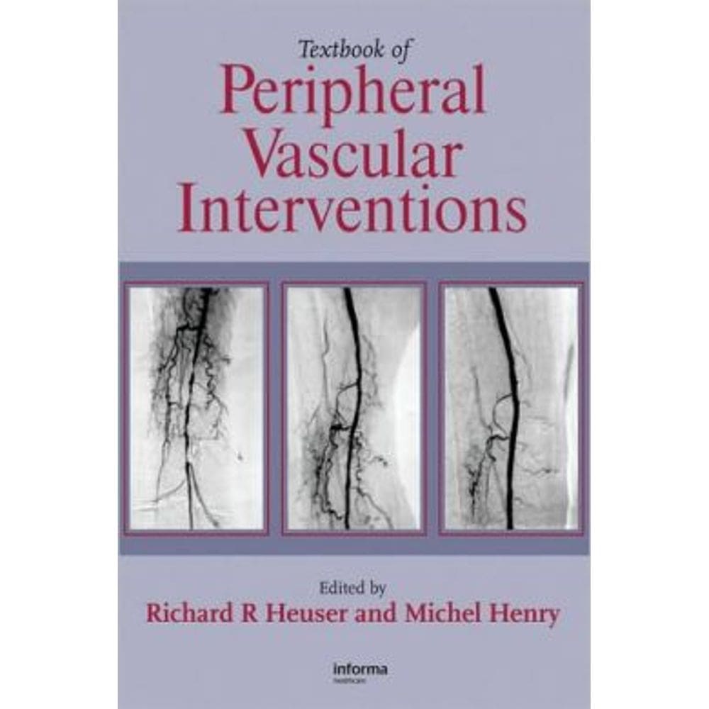 Textbook Of Peripheral Vascular Interventions