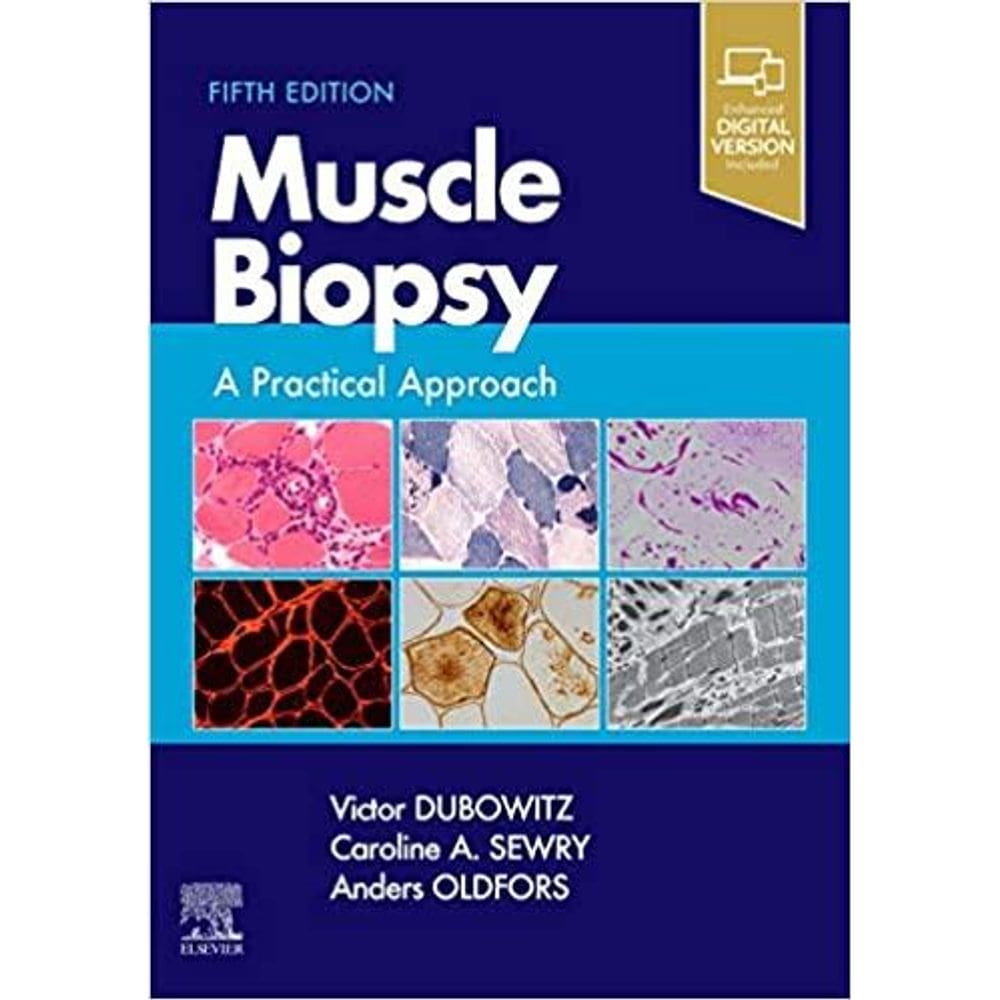 Muscle Biopsy